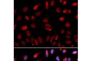 Immunofluorescence analysis of U2OS cells using HUS1 Polyclonal Antibody (HUS1 antibody)