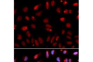 Immunofluorescence analysis of U2OS cells using HUS1 Polyclonal Antibody