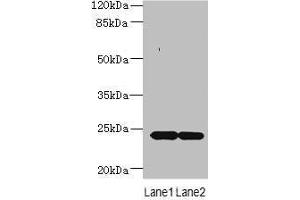 Western blot All lanes: MRAP2 antibody at 7 μg/mL Lane 1: Mouse brain tissue Lane 2: Mouse kidney tissue Secondary Goat polyclonal to rabbit IgG at 1/10000 dilution Predicted band size: 24 kDa Observed band size: 24 kDa (MRAP2 antibody  (AA 66-205))