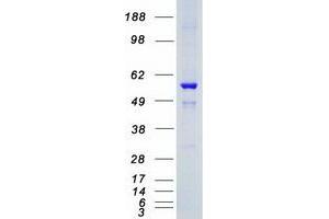 Validation with Western Blot