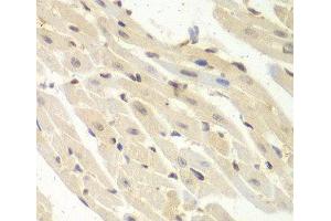 Immunohistochemistry of paraffin-embedded Mouse heart using PSME1 Polyclonal Antibody at dilution of 1:100 (40x lens).