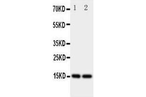 Western Blotting (WB) image for anti-Fatty Acid Binding Protein 5 (Psoriasis-Associated) (FABP5) (AA 10-23), (N-Term) antibody (ABIN3044084) (FABP5 antibody  (N-Term))