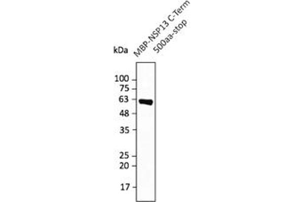 SARS-CoV-2 NSP13 antibody  (C-Term)