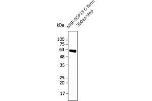 Western Blotting (WB) image for anti-SARS-CoV-2 Helicase (NSP13) (HEL) (C-Term) antibody (ABIN7273005) (SARS-CoV-2 NSP13 antibody  (C-Term))