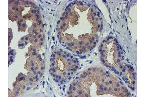Immunohistochemical staining of paraffin-embedded Human breast tissue using anti-VCAM1 mouse monoclonal antibody. (VCAM1 antibody)