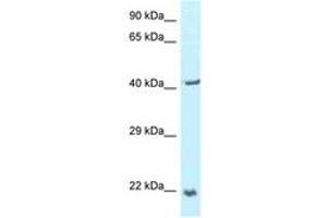 Image no. 1 for anti-Tumor Protein D52-Like 2 (TPD52L2) (AA 118-167) antibody (ABIN6747351) (TPD52L2 antibody  (AA 118-167))