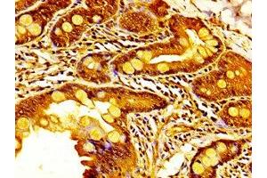 IHC image of ABIN7158716 diluted at 1:400 and staining in paraffin-embedded human small intestine tissue performed on a Leica BondTM system. (KDM6A antibody  (AA 620-749))