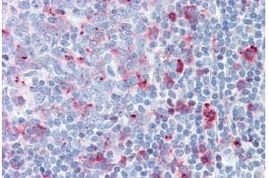 Human Tonsil: Formalin-Fixed, Paraffin-Embedded (FFPE) (CTSC antibody)