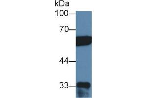 Western blot analysis of Human HeLa cell lysate, using Human PTBP1 Antibody (2 µg/ml) and HRP-conjugated Goat Anti-Rabbit antibody ( (PTBP1 antibody  (AA 1-531))