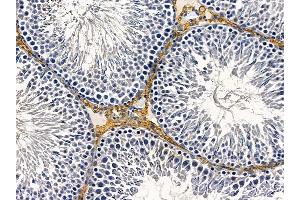 ABIN6258237 and ABIN6274591 at 1/100 staining rat testis tissue by IHC-P.