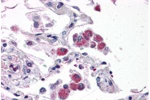 Human Lung: Formalin-Fixed, Paraffin-Embedded (FFPE) (FAM59B antibody  (C-Term))