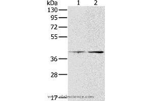 Western blot analysis of Hela and lovo cell, using PDGFRL Polyclonal Antibody at dilution of 1:400 (PDGFRL antibody)