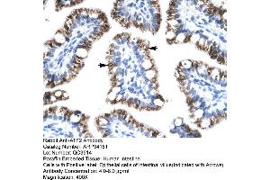 Human Intestine (ATF2 antibody  (C-Term))