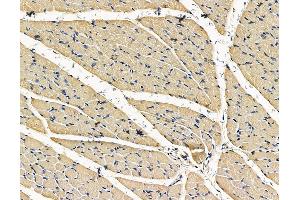 ABIN7096733 and ABIN7100798 at 1/100 staining rat muscle tissue by IHC-P. (TRABD antibody)