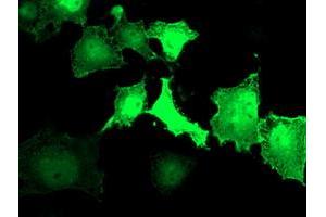 Anti-LDLRAP1 mouse monoclonal antibody (ABIN2455230) immunofluorescent staining of COS7 cells transiently transfected by pCMV6-ENTRY LDLRAP1 (RC206643). (LDLRAP1 antibody)
