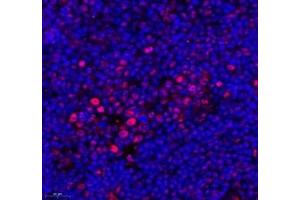 Immunofluorescence of paraffin embedded mouse spleen using ZC3H11A (ABIN7076255) at dilution of 1: 650 (550x lens) (ZC3H11A antibody)