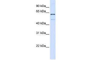 Western Blotting (WB) image for anti-Methyltransferase Like 16 (METTL16) antibody (ABIN2459138) (METTL16 antibody)