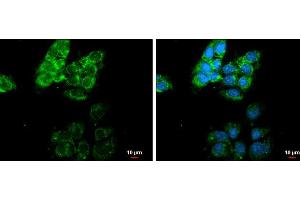 ICC/IF Image MMP13 antibody [N3C1], Internal detects MMP13 protein at cytoplasm by immunofluorescent analysis. (MMP13 antibody)