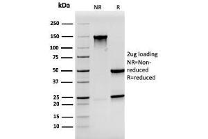 SDS-PAGE Analysis Purified Synaptophysin Mouse Monoclonal Antibody (SYP/3551).