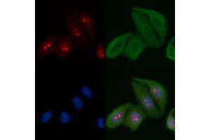 ABIN6263193 and ABIN6266724 staining Hela cells by IF/ICC. (MED24 antibody  (C-Term))