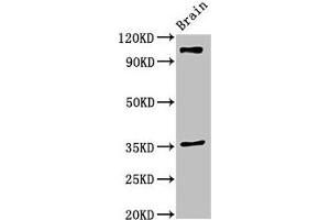 Western Blot Positive WB detected in: Mouse brain tissue All lanes: SLITRK5 antibody at 2 μg/mL Secondary Goat polyclonal to rabbit IgG at 1/50000 dilution Predicted band size: 108, 80 kDa Observed band size: 108 kDa (SLITRK5 antibody  (AA 617-890))