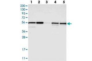 Western blot analysis of Lane 1: RT-4, Lane 2: U-251 MG, Lane 3: Human Plasma, Lane 4: Liver, Lane 5: Tonsil with PMPCA polyclonal antibody  at 1:250-1:500 dilution. (PMPCA antibody)