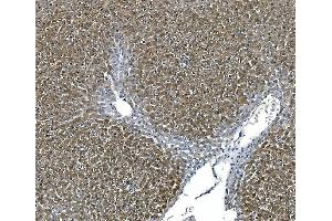 IHC analysis of ASS1 using anti-ASS1 antibody (ABIN7601191). (ASS1 antibody  (AA 3-365))