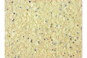 Immunohistochemistry of paraffin-embedded human brain tissue using ABIN7145442 at dilution of 1:100 (CNDP1 antibody  (AA 1-280))