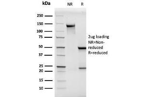 SDS-PAGE Analysis Purified MCAM Mouse Monoclonal Antibody (MCAM/3046). (MCAM antibody  (AA 226-374))