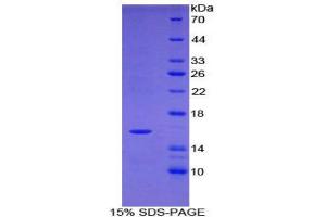 SDS-PAGE (SDS) image for Tryptase delta 1 (TPSD1) (AA 99-191) protein (His tag) (ABIN2123866)