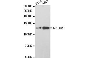 Western Blotting (WB) image for anti-Solute Carrier Family 4, Sodium Bicarbonate Cotransporter, Member 4 (SLC4A4) antibody (ABIN1876520) (SLC4A4 antibody)