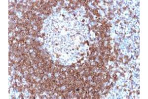 Immunohistochemical staining (Formalin-fixed paraffin-embedded sections) of human tonsil with CD79A polyclonal antibody . (CD79a antibody)