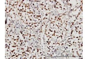 Image no. 3 for anti-Ubiquitin Specific Peptidase 34 (USP34) (AA 3296-3396) antibody (ABIN599094) (USP34 antibody  (AA 3296-3396))