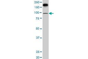 PML antibody  (AA 411-510)