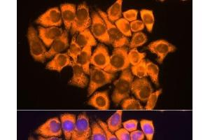 Immunofluorescence analysis of HeLa cells using RPL17 Polyclonal Antibody at dilution of 1:100.