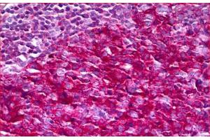 Anti-NF1 antibody IHC staining of human tonsil. (Neurofibromin 1 antibody  (AA 1551-1600))