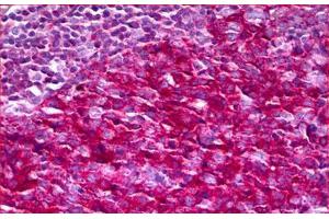 Anti-NF1 antibody IHC staining of human tonsil. (Neurofibromin 1 antibody  (AA 1551-1600))