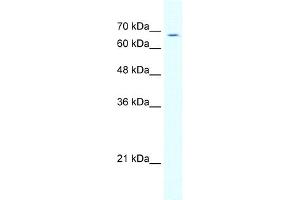 WB Suggested Anti-GABRD Antibody   Titration: 5. (GABRD antibody  (N-Term))