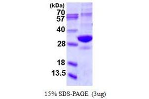SDS-PAGE (SDS) image for Proteasome Subunit alpha 5 (PSMA5) (AA 1-241) protein (His tag) (ABIN667634) (PSMA5 Protein (AA 1-241) (His tag))