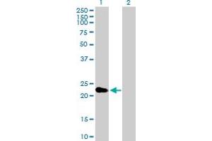 Western Blot analysis of CRYBA2 expression in transfected 293T cell line by CRYBA2 MaxPab polyclonal antibody. (CRYbA2 antibody  (AA 1-197))