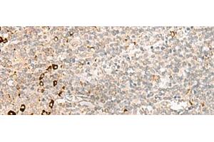 Immunohistochemistry of paraffin-embedded Human tonsil tissue using RMND5A Polyclonal Antibody at dilution of 1:50(x200) (RMND5A antibody)