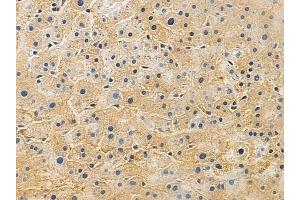 anti-Pipecolic Acid Oxidase (PIPOX) (Internal Region) antibody