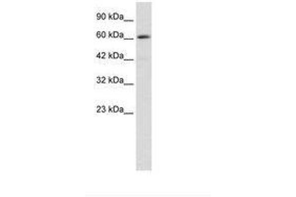 ZBTB45 anticorps  (AA 200-249)