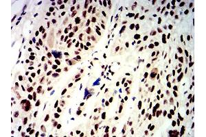 Immunohistochemistry (IHC) image for anti-Apurinic/Apyrimidinic Endonuclease 1 (APEX1) (AA 219-318) antibody (ABIN5611191)