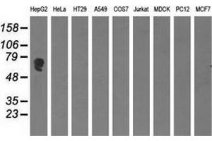 Western blot analysis of extracts (35 µg) from 9 different cell lines by using anti-AFP monoclonal antibody. (alpha Fetoprotein antibody)