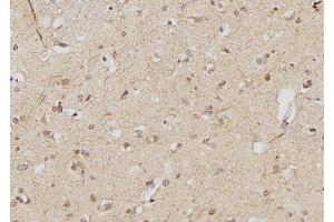 ABIN6261810 and ABIN6268934 at 1/100 staining Human brain tissue by IHC-P. (FOXP3 antibody  (C-Term))