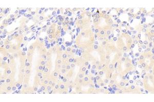 Detection of a4GALT in Mouse Kidney Tissue using Polyclonal Antibody to Alpha-1,4-Galactosyltransferase (a4GALT) (A4GALT antibody  (AA 94-270))