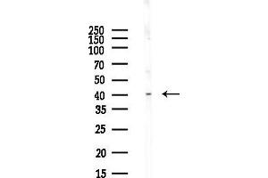 anti-Chemokine (C-C Motif) Receptor 6 (CCR6) (N-Term) antibody