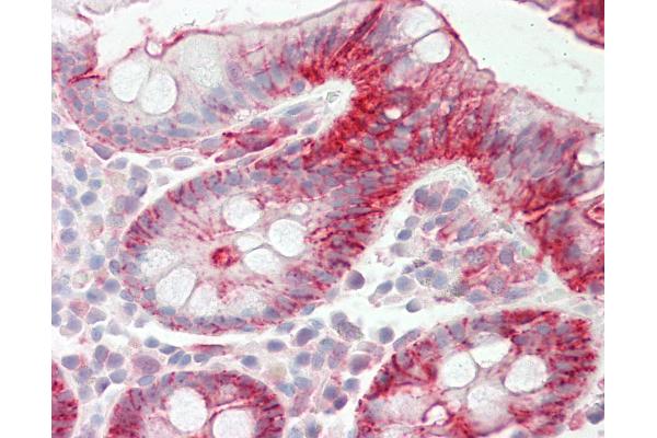 LIMA1 antibody  (C-Term)