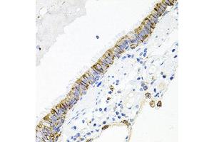 Immunohistochemistry of paraffin-embedded human lung using ACVR2A antibody at dilution of 1:100 (x40 lens). (ACVR2A antibody)
